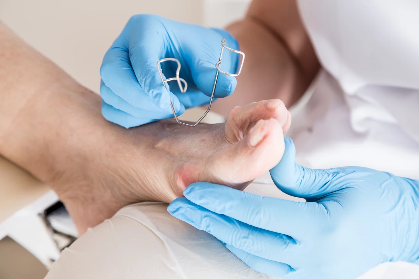 Pedicure leczniczy - co na ten temat wiedzieć trzeba?