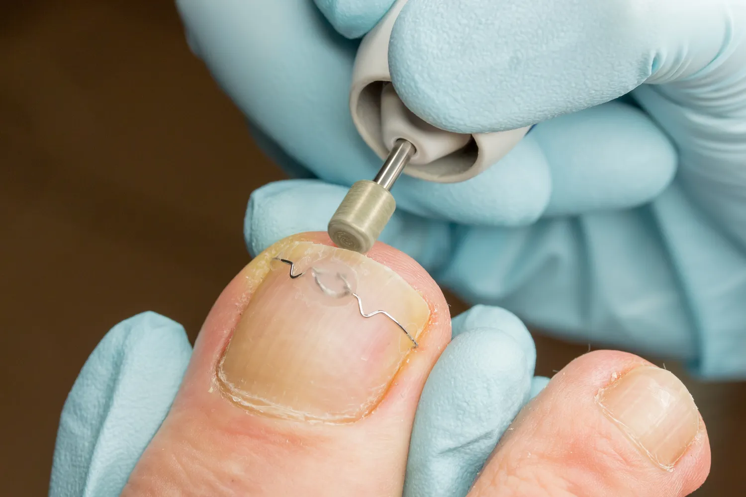 Podologia - zdrowe i ładne stopy